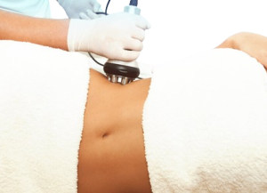 Radio Frequência