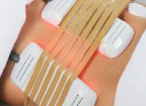 Lipo laser